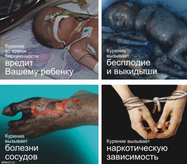 Эти изображения были утверждены Советом по здравоохранению стран ЕврАзЭС и одобрены экспертным советом при Минздравсоцразвития России